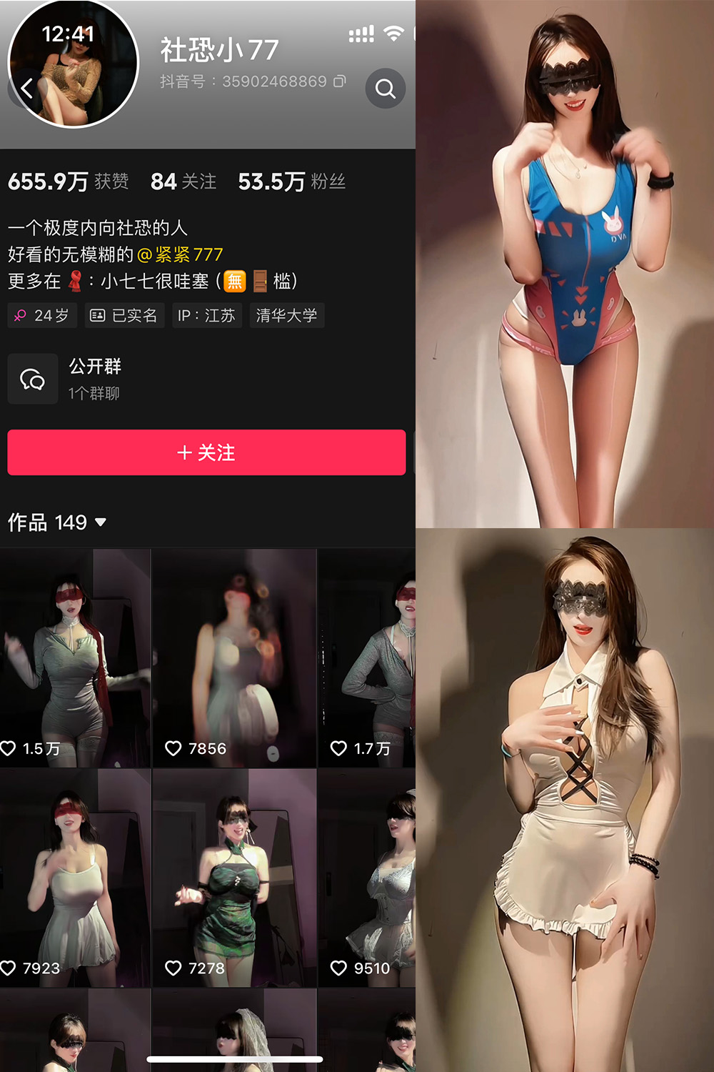 抖音 社恐小77 微密圈 002期 【20V】最新至：2025.3.11