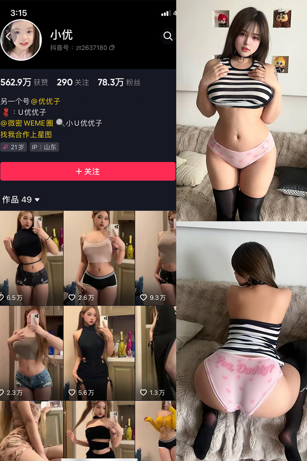 抖音 小U优优子 VIP 微密圈 NO.061期 【20P1V】最新至：2025.4.25